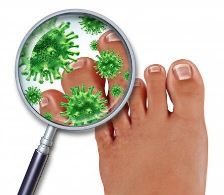 infecção fúngica nos pés